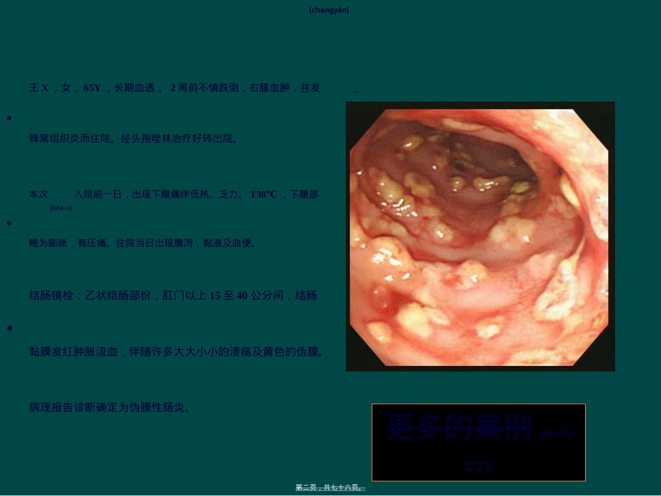 艰难梭菌感染：持续的挑战20100627sific.ppt（大秘书文库）_第2页