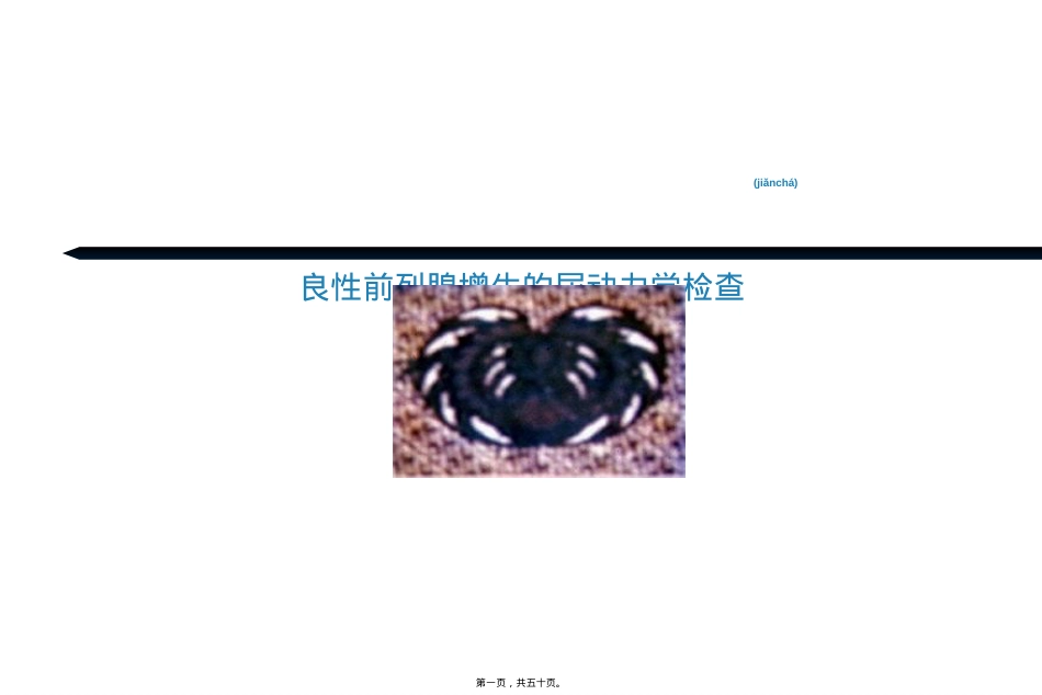 良性前列腺增生的尿动力学检查.ppt（大秘书文库）_第1页