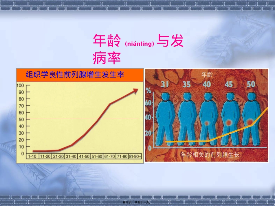 良性前列腺增生症的中西医诊治.ppt（大秘书文库）_第3页