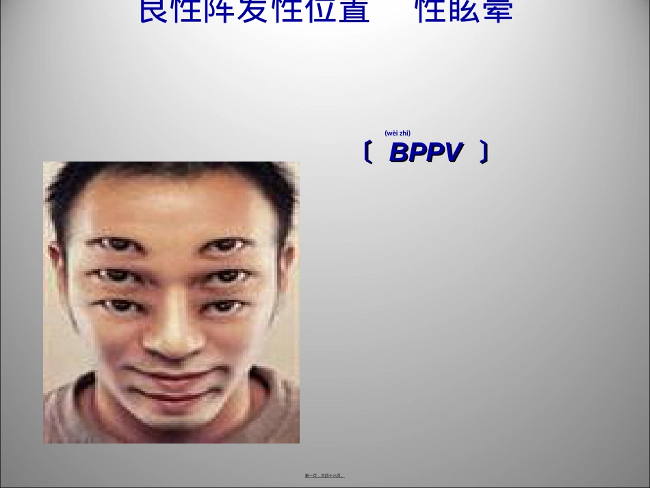 良性阵发性位置性眩晕(耳石症).ppt（大秘书文库）_第1页