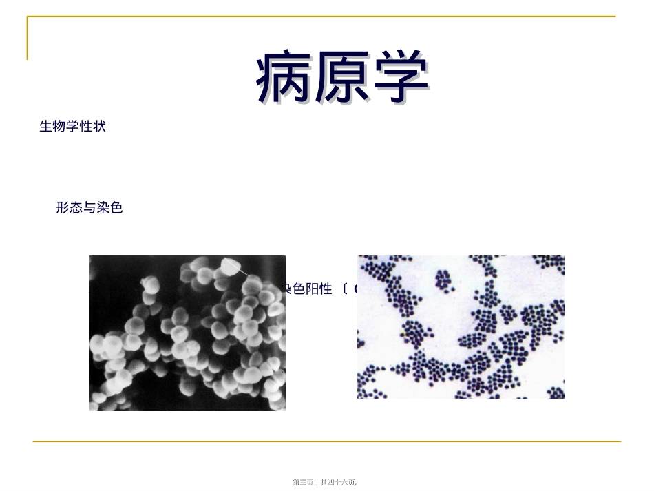 葡萄球菌病.ppt（大秘书文库）_第3页