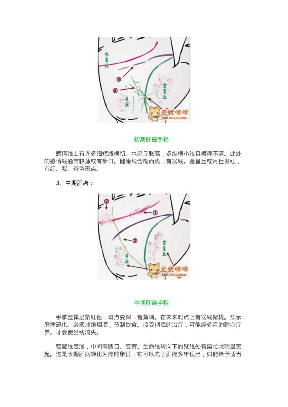 医学专题—做自己的医生24种手相揭示身心健康问题.docx_第2页
