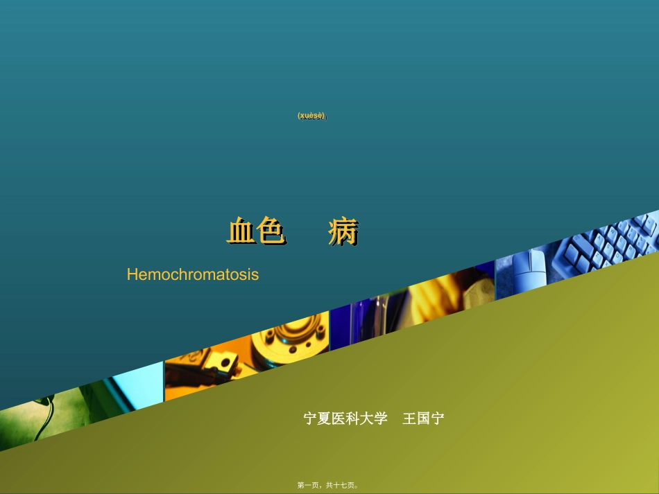 血色病.ppt（大秘书文库）_第1页
